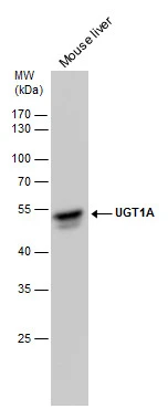 UGT1A antibody detects UGT1A protein by western blot analysis. Mouse tissue extracts (50 μg) was separated by 10 % SDS-PAGE, and the membrane was blotted with UGT1A antibody (GTX114128) diluted by 1:2000.