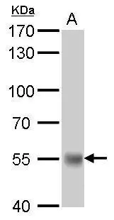 UGT1A antibody detects UGT1A protein by Western blot analysis. A. 50 μg rat liver lysate/extract 7.5 % SDS-PAGE UGT1A antibody (GTX114131) dilution: 1:5000