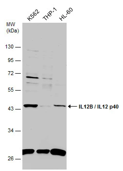 Various whole cell extracts (30 ug) were separated by 10% SDS-PAGE,and the membrane was blotted with IL12B / IL12 p40 antibody (GTX114135) diluted at 1:1000.