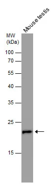 RAN antibody