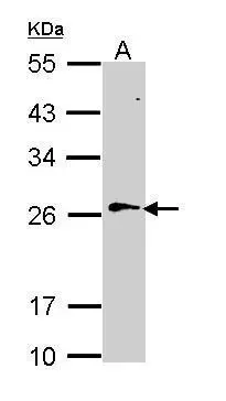 RAN antibody detects RAN protein by western blot analysis. Mouse tissue extracts (50 ug) was separated by 12% SDS-PAGE,and the membrane was blotted with RAN antibody (GTX114139) diluted at 1:1000.