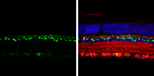 CHX10 antibody detects CHX10 protein by immunohistochemical analysis. Samples: Paraffin-embedded mouse retina. Green: CHX10 protein stained by CHX10 antibody (GTX114143) diluted at 1:250. Red: beta Tubulin 3/ Tuj1, a marker, stained by beta Tubulin 3/ Tuj1 antibody [GT1338] (GTX631831) diluted at 1:500. Blue: Fluoroshield with DAPI (GTX30920). 
 Antigen Retrieval: Citrate buffer, pH 6.0, 15 min