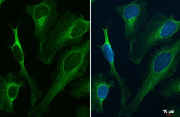 Renin Receptor antibody detects Renin Receptor protein at endoplasmic reticulum by immunofluorescent analysis. Sample: HeLa cells were fixed in ice-cold MeOH for 5 min. Green: Renin Receptor stained by Renin Receptor antibody (GTX114169) diluted at 1:500.