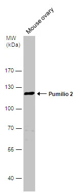 Mouse tissue extract (50 μg) was separated by 7.5% SDS-PAGE, and the membrane was blotted with Pumilio 2 antibody [C2C3], C-term (GTX114172) diluted at 1:500.