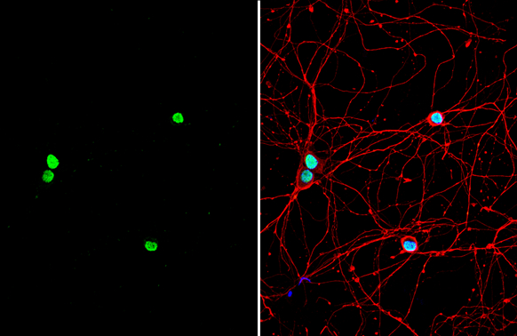 Pumilio 2 antibody [C2C3], C-term detects Pumilio 2 protein by immunofluorescent analysis. Sample: DIV9 rat E18 primary hippocampal neuron cells were fixed in 4% paraformaldehyde at RT for 15 min. Green: Pumilio 2 stained by Pumilio 2 antibody [C2C3], C-term (GTX114172) diluted at 1:500. Red: beta Tubulin 3/ Tuj1, stained by beta Tubulin 3/ Tuj1 antibody [GT11710] (GTX631836) diluted at 1:500. Blue: Fluoroshield with DAPI (GTX30920).