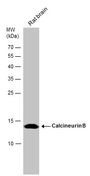 Calcineurin B antibody