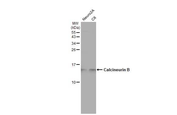 Calcineurin B antibody