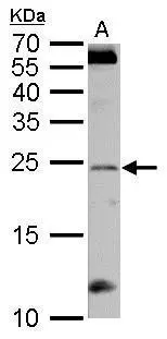 RGS4 antibody detects RGS4 protein by western blot analysis. A. 50 μg rat brain lysate/extract 12% SDS-PAGE RGS4 antibody (GTX114184) dilution: 1:1000 The HRP-conjugated anti-rabbit IgG antibody (GTX213110-01) was used to detect the primary antibody.
