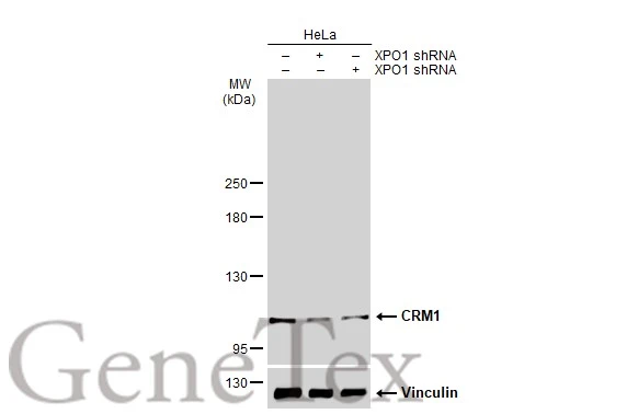 Non-transfected (–) and transfected (+) HeLa whole cell extracts (30 μg) were separated by 5% SDS-PAGE, and the membrane was blotted with CRM1 antibody [N1N2], N-term (GTX114188) diluted at 1:1000. The HRP-conjugated anti-rabbit IgG antibody (GTX213110-01) was used to detect the primary antibody.