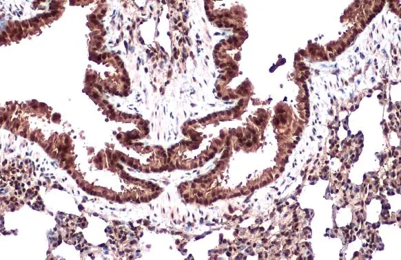 CRM1 antibody [N1N2], N-term detects CRM1 protein at nucleus by immunohistochemical analysis. Sample: Paraffin-embedded mouse lung. CRM1 stained by CRM1 antibody [N1N2], N-term (GTX114188) diluted at 1:500. Antigen Retrieval: Citrate buffer, pH 6.0, 15 min