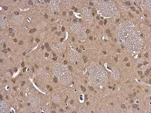 Glutathione reductase antibody [N2C2], Internal detects Glutathione reductase protein at cytoplasm and nucleus in rat brain by immunohistochemical analysis. Sample: Paraffin-embedded rat brain. Glutathione reductase antibody [N2C2], Internal (GTX114199) diluted at 1:500. 
 Antigen Retrieval: Citrate buffer, pH 6.0, 15 min
