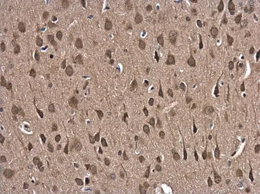 Glutathione reductase antibody [N2C2], Internal detects Glutathione reductase protein at cytoplasm and nucleus in rat brain by immunohistochemical analysis. Sample: Paraffin-embedded rat brain. Glutathione reductase antibody [N2C2], Internal (GTX114199) diluted at 1:500. 
 Antigen Retrieval: Citrate buffer, pH 6.0, 15 min