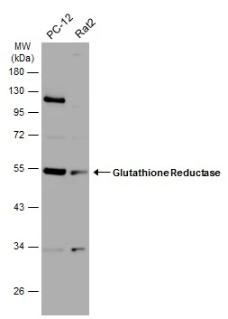 Various whole cell extracts (30 μg) were separated by 10% SDS-PAGE, and the membrane was blotted with Glutathione Reductase antibody (GTX114199) diluted at 1:1000. The HRP-conjugated anti-rabbit IgG antibody (GTX213110-01) was used to detect the primary antibody.