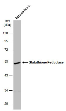 Mouse tissue extract (50 μg) was separated by 10% SDS-PAGE, and the membrane was blotted with Glutathione reductase (GTX114199) diluted at 1:1000. The HRP-conjugated anti-rabbit IgG antibody (GTX213110-01) was used to detect the primary antibody.