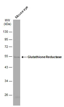 Mouse tissue extract (50 μg) was separated by 10% SDS-PAGE, and the membrane was blotted with Glutathione reductase (GTX114199) diluted at 1:1000. The HRP-conjugated anti-rabbit IgG antibody (GTX213110-01) was used to detect the primary antibody.