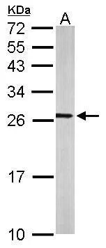 Sample (50 ug of whole cell lysate) A: mouse brain 12% SDS PAGE GTX114204 diluted at 1:500
