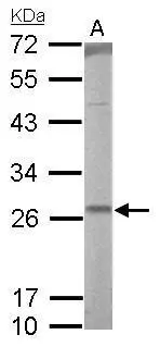 RALA antibody detects RALA protein by Western blot analysis. A. 50 μg rat lung lysate/extract 12 % SDS-PAGE RALA antibody (GTX114204) dilution: 1:1000