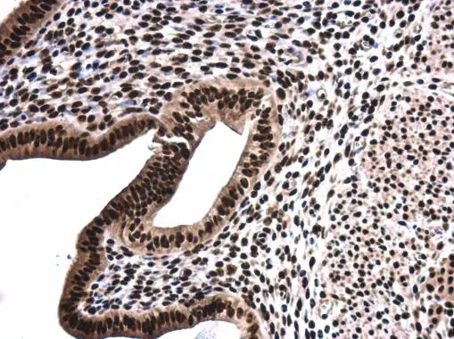 SFPQ antibody [N2C1], Internal detects SFPQ protein at cytoplasm and nucleus in mouse cervix by immunohistochemical analysis. Sample: Paraffin-embedded mouse cervix. SFPQ antibody [N2C1], Internal (GTX114209) diluted at 1:500. 
 Antigen Retrieval: Citrate buffer, pH 6.0, 15 min