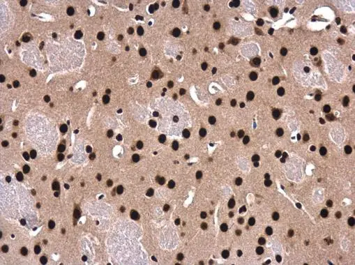 SFPQ antibody [N2C1], Internal detects SFPQ protein at cytoplasm and nucleus in mouse fore brain by immunohistochemical analysis. Sample: Paraffin-embedded mouse fore brain. SFPQ antibody [N2C1], Internal (GTX114209) diluted at 1:500. 
 Antigen Retrieval: Citrate buffer, pH 6.0, 15 min
