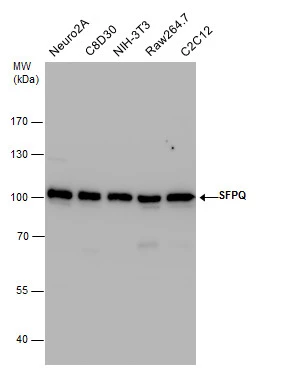 SFPQ antibody detects SFPQ protein by Western blot analysis. Various whole cell extracts (30 μg) were separated by 7.5% SDS-PAGE, and the membrane was blotted with SFPQ antibody (GTX114209) diluted by 1:10000.
