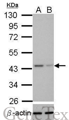 Various whole cell extracts (30 ug) were separated by 10% SDS-PAGE,and the membrane was blotted with TDP43 antibody (GTX114210) diluted at 1:1000. The HRP-conjugated anti-rabbit IgG antibody (GTX213110-01) was used to detect the primary antibody.