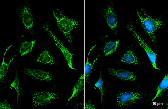 ACADVL antibody [N1C1] detects ACADVL protein at mitochondria by immunofluorescent analysis. Sample: HeLa cells were fixed in ice-cold MeOH for 5 min. Green: ACADVL stained by ACADVL antibody [N1C1] (GTX114232) diluted at 1:500. Blue: Fluoroshield with DAPI (GTX30920). Scale bar= 10 μm.