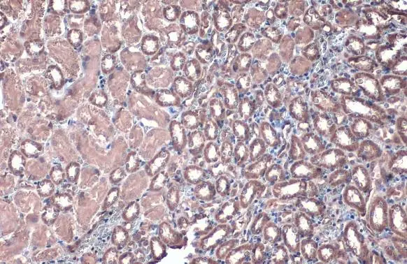ACADVL antibody [N1C1] detects ACADVL protein at cytoplasm by immunohistochemical analysis. Sample: Paraffin-embedded mouse kidney. ACADVL stained by ACADVL antibody [N1C1] (GTX114232) diluted at 1:500. Antigen Retrieval: Citrate buffer, pH 6.0, 15 min