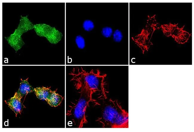 ICC/IF analysis of Neuro-2a cells using GTX11424 EDG1 antibody. Panel e is a no primary antibody control. Green : Primary antibody Blue : Nuclei Red : Actin Fixation : 4% paraformaldehyde Permeabilization : 0.1% Trito X-100 for 10 minutes Dilution : 2 microg/ml in 0.1% BSA and incubated for 3 hours at room temperature