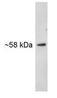 WB analysis of canine lysate using GTX11425 SNTB2 antibody [1351].