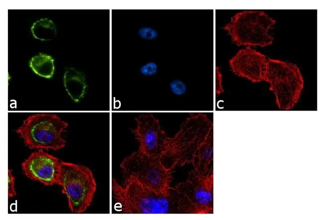 ICC/IF analysis of PC-3 cells using GTX11425 SNTB2 antibody [1351]. Panel e is a no primary antibody control. Green : Primary antibody Blue : Nuclei Red : Actin Fixation : 4% paraformaldehyde Permeabilization : 0.1% Trito X-100 for 10 minutes Dilution : 2 microg/ml in 0.1% BSA and incubated for 3 hours at room temperature