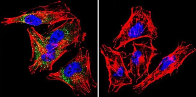 ICC/IF analysis of A2058 Cells using GTX11425 SNTB2 antibody [1351]. Cells were probed without (right) or with (left) an antibody. Green : Primary antibody Blue : Nuclei Red : Actin Fixation : formaldehyde Dilution : 1:20 overnight at 4oC