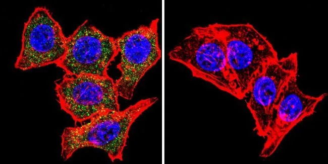ICC/IF analysis of HeLa cells using GTX11425 SNTB2 antibody [1351]. Cells were probed without (right) or with (left) an antibody. Green : Primary antibody Blue : Nuclei Red : Actin Fixation : formaldehyde Dilution : 1:20 overnight at 4oC