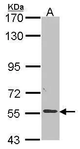 Sample (30 ug of whole cell lysate) A: A549 7.5% SDS PAGE ALPPL2 antibody GTX114250 diluted at 1:1000 
