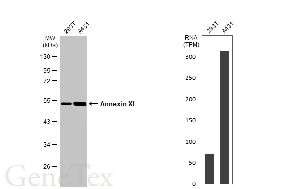 Various whole cell extracts (30 μg) were separated by 10% SDS-PAGE, and the membrane was blotted with Annexin XI antibody (GTX114255) diluted at 1:1000. The HRP-conjugated anti-rabbit IgG antibody (GTX213110-01) was used to detect the primary antibody. Corresponding RNA expression data for the same cell lines are based on Human Protein Atlas program.