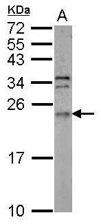 Sample (50 ug of whole cell lysate) A: mouse brain 12% SDS PAGE GTX114264 diluted at 1:1000
