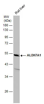 Rat tissue extract (50 μg) was separated by 10% SDS-PAGE, and the membrane was blotted with ALDH7A1 antibody [C1C3] (GTX114274) diluted at 1:3000.