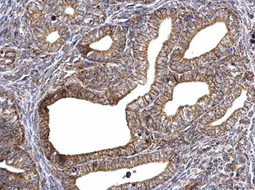 ATP synthase gamma antibody detects ATP synthase gamma protein at mitochondria on mouse cervix by immunohistochemical analysis. Sample: Paraffin-embedded mouse cervix. ATP synthase gamma antibody (GTX114275) dilution: 1:500. 
 Antigen Retrieval: Trilogy? (EDTA based, pH 8.0) buffer, 15min