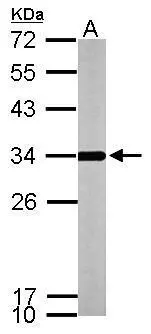 Sample (50 μg of whole cell lysate) A: mouse brain 12% SDS PAGE GTX114275 diluted at 1:1000 The HRP-conjugated anti-rabbit IgG antibody (GTX213110-01) was used to detect the primary antibody.