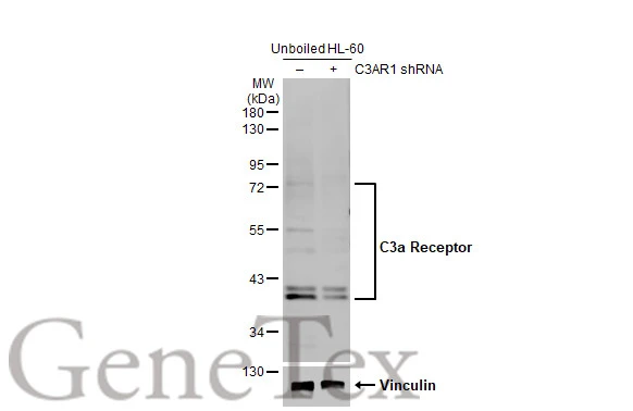 Non-transfected (–) and transfected (+) unboiled HL-60 whole cell extracts (30 μg) were separated by 10% SDS-PAGE, and the membrane was blotted with C3a Receptor antibody (GTX114293) diluted at 1:500. The HRP-conjugated anti-rabbit IgG antibody (GTX213110-01) was used to detect the primary antibody, and the signal was developed with Trident ECL plus-Enhanced.