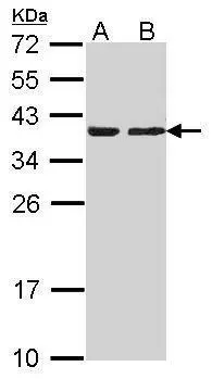 Sample (30 ug of whole cell lysate) A: Hep G2 (GTX27900) B: HCT116 12% SDS PAGE CAPZA2 antibody GTX114303 diluted at 1:1000 