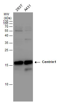 Centrin 1 antibody detects Centrin 1 protein by western blot analysis. Various whole cell extracts (30 ug) were separated by 15% SDS-PAGE,and the membrane was blotted with Centrin 1 antibody (GTX114316) diluted at a dilution of 1:1000.
