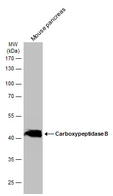 Mouse tissue extract (50 μg) was separated by 10% SDS-PAGE, and the membrane was blotted with Carboxypeptidase B antibody [N3C3] (GTX114334) diluted at 1:50000. The HRP-conjugated anti-rabbit IgG antibody (GTX213110-01) was used to detect the primary antibody.
