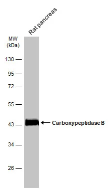 Rat tissue extract (50 μg) was separated by 10% SDS-PAGE, and the membrane was blotted with Carboxypeptidase B antibody [N3C3] (GTX114334) diluted at 1:50000. The HRP-conjugated anti-rabbit IgG antibody (GTX213110-01) was used to detect the primary antibody.