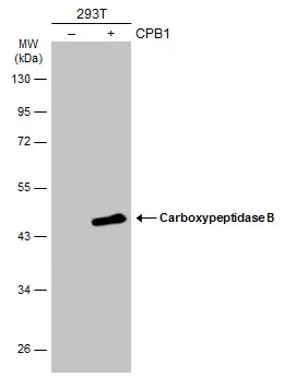 Non-transfected (–) and transfected (+) 293T whole cell extracts (30 μg) were separated by 10% SDS-PAGE, and the membrane was blotted with Carboxypeptidase B antibody [N3C3] (GTX114334) diluted at 1:5000. The HRP-conjugated anti-rabbit IgG antibody (GTX213110-01) was used to detect the primary antibody.