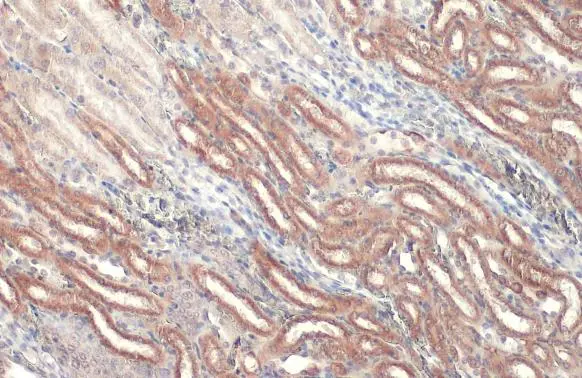 CPT1A antibody [C1C2], Internal detects CPT1A protein at mitochondria by immunohistochemical analysis. Sample: Paraffin-embedded mouse kidney. CPT1A stained by CPT1A antibody [C1C2], Internal (GTX114337) diluted at 1:500. Antigen Retrieval: Citrate buffer, pH 6.0, 15 min