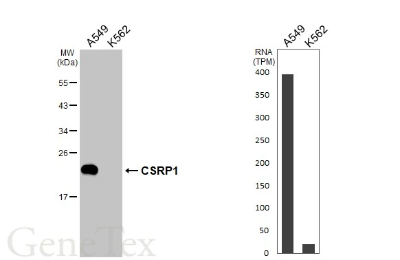 Various whole cell extracts (30 μg) were separated by 12% SDS-PAGE, and the membrane was blotted with CSRP1 antibody [N1C3] (GTX114344) diluted at 1:1000. The HRP-conjugated anti-rabbit IgG antibody (GTX213110-01) was used to detect the primary antibody. Corresponding RNA expression data for the same cell lines are based on Human Protein Atlas program.