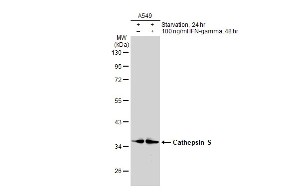 Untreated (–) and treated (+) A549 whole cell extracts (30 μg) were separated by 10% SDS-PAGE, and the membrane was blotted with Cathepsin S antibody (GTX114350) diluted at 1:1000. The HRP-conjugated anti-rabbit IgG antibody (GTX213110-01) was used to detect the primary antibody. Untreated (–) and treated (+) A549 whole cell extracts (30 μg) were separated by 10% SDS-PAGE, and the membrane was blotted with Cathepsin S antibody (GTX114350) diluted at 1:1000. The HRP-conjugated anti-rabbit IgG antibody (GTX213110-01) was used to detect the primary antibody.