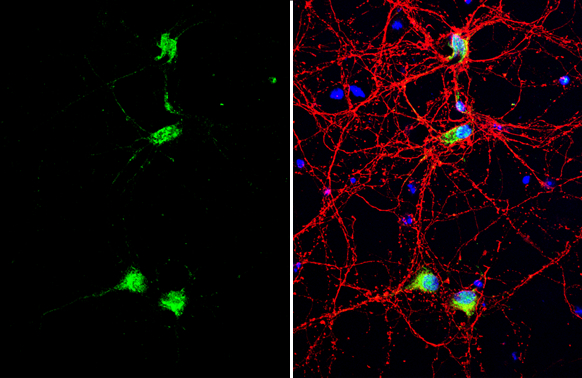 CUTL1 antibody detects CUTL1 protein by immunofluorescent analysis. Sample: DIV10 rat E18 primary cortical neuron cells were fixed in 4% paraformaldehyde at RT for 15 min. Green: CUTL1 stained by CUTL1 antibody (GTX114351) diluted at 1:500. Red: Tau, stained by Tau antibody [GT287] (GTX634809) diluted at 1:500. Blue: Fluoroshield with DAPI (GTX30920).