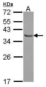 Immunofluorescence analysis of paraformaldehyde-fixed A549,using E2F6(GTX114373) antibody at 1:500 dilution.