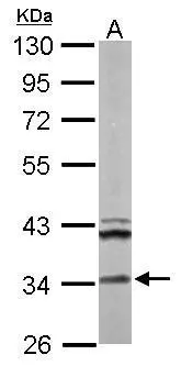 Sample (50 ug of whole cell lysate) A: Mouse brain 10% SDS PAGE GTX114374 diluted at 1:1000 Sample (50 ug of whole cell lysate) A: Mouse brain 10% SDS PAGE GTX114374 diluted at 1:1000